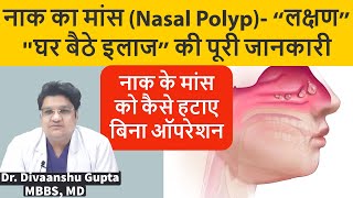 Nasal Polyps नाक के बढे हुए मांस का इलाज कैसे करे  Naak me Maas ka Badhna Nasal Polyps Treatment [upl. by Roselin600]