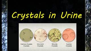 Urine Examination3 Crystals [upl. by Trask]