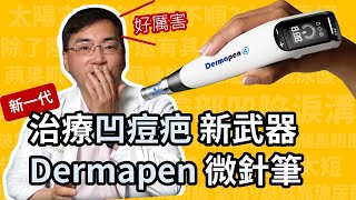 治凹痘疤，新武器 Dermapen 得美微針筆，第四代微針筆，治療凹痘疤快速又方便！ [upl. by Ammadas]