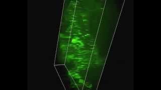 CrestOptics  Fluorescent confocal microscopy with XLight Confocal Imager System 2 [upl. by Atterol]