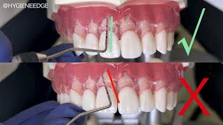 All Things Periodontal Probing with Kilgore International [upl. by Sydelle271]