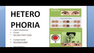 Ophthalmology 357 HeteroPhoria Latent Strabismus Squint Compensation DeCompensation [upl. by Anilag]