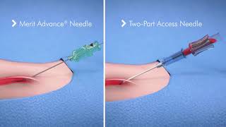 PreludeEASE™ Hydrophilic Sheath Introducer [upl. by Ty812]