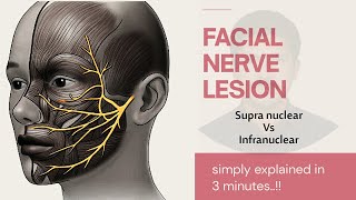 Facial nerve lesion  Supranuclear Vs Infranuclear  Bells Palsy explained  Anatomy  Medical [upl. by Demitria]