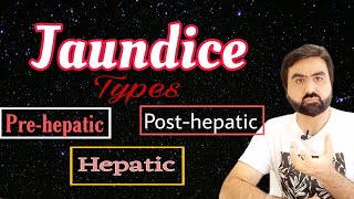 Jaundice  Types of Jaundice  Prehepatic  Hepatic  Posthepatic  UrduHindi [upl. by Niuqaoj]