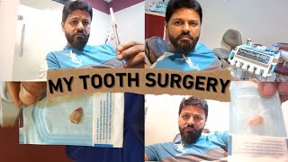 wisdom teeth removal surgery extraction in under one minute surprise [upl. by Notlek]