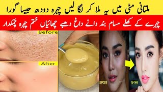 Multani Mitti face pack for glowing skinmultani mitti for skin whitening❤multani mitti benifits [upl. by Stirling]