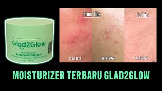 REVIEW LENGKAP GLAD2GLOW ACNE MOISTURIZER [upl. by Cody406]