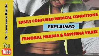 Inguinal hernias in under 2 minutes [upl. by Chew225]