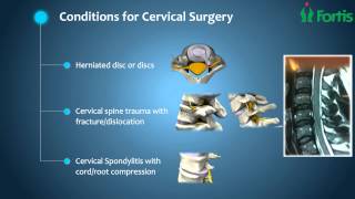 Anterior Cervical Discectomy amp Fusion  Spine Surgery Neuro Surgery Fortis HealthcareIndia [upl. by Ithsav326]