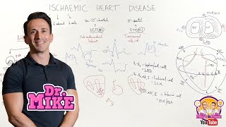 Ischemic Heart Disease Coronary Artery Disease [upl. by Xylon960]