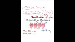 Mallampati classificationanesthesia Fmge Important topic spot [upl. by Llenrup]