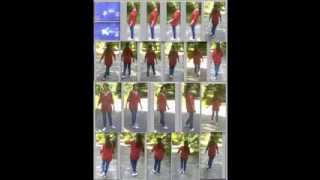 Video 9  Ataxia  Freeze frames  Ataxie  Arrêts sur images [upl. by Arihs]