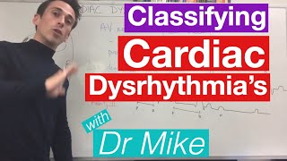 Cardiac dysrhythmias arrhythmias common [upl. by Ahcsrop]