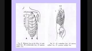 Precordium Palpation Percussion [upl. by Adnilem881]