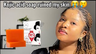 Stop using kojie San soapkojie San soap review kojic acid soapkojie San skin lightening soap [upl. by Byrn379]