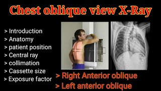 Chest Oblique view XRay  Part 1  Right amp Left Anterior oblique view  By BL Kumawat [upl. by Mullac733]