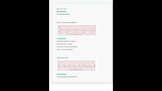 Relias Dysrhythmia Basic A Questions amp Answers All Correct amp Verified [upl. by Kenison]