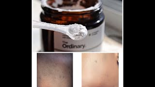 How to use the Ordinary LAscorbic Acid Powder For Bright Glowing Skin 2019 [upl. by Atilal]