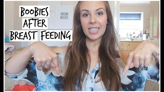 VLOG 1 ENGORGED BREASTS AFTER BREAST FEEDING  KERRY DYER [upl. by Tyra]