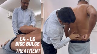 L4  L5 disc bulge treatment by dr harish grover [upl. by Eboj]