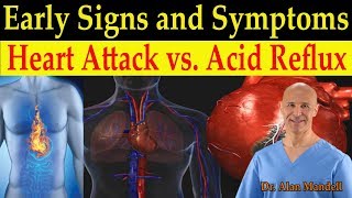 Identifying Heart Attack vs Acid Reflux GERD Early Warning Signs amp Symptoms  Dr Mandell DC [upl. by Assilrac]