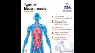 Black Fungus Infection  Mucormycosis Disease Causes Symptoms Diagnosis and Treatment [upl. by Akinoj]