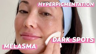 Dark Spot Treatments Products I Love for Melasma amp Hyperpigmentation  Skincare with SusanYara [upl. by Dami225]