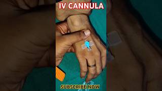 IV CANNULA INSERTION 🩺💉🩺💉🩺💉💉💉💉💉🩺💉cannula youtubeshorts shortshospital viral medicarenurshing [upl. by Madge]