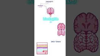 MENINGITIS  DEFINICIÓN MÉDICA  Interpretación Consecutiva [upl. by Oinegue]