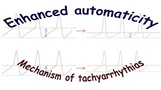 Enhanced automaticity Mechanism of tachyarrhythmias [upl. by Pazit]