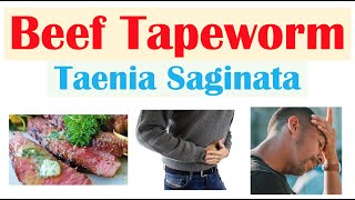 Beef Tapeworm Taeniasis  How It Infects Signs amp Symptoms Diagnosis Treatment Prevention [upl. by Dud479]