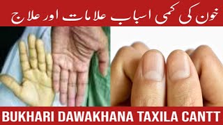 Causes Symptoms and Effective Treatment of Anemia  خون کی کمی اسباب علامات اور علاج [upl. by Ottie988]