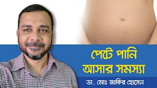 Ascites Treatment  How is ascites treated  পেটে পানি আসলে করণীয়  পেটে পানি জমার লক্ষণ [upl. by Burget]