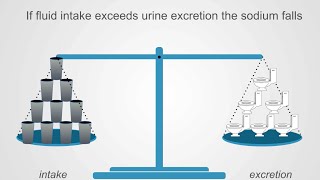 Hyponatremia Basics Understanding Water Intake amp Urine Output [upl. by Ahsiekin509]