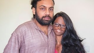 Acid Attack Victim Finds Love With Fellow Campaigner [upl. by Baudelaire]