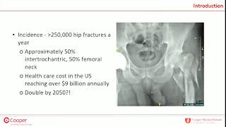 IM nail vs SHS for intertrochanteric femur fractures  debate [upl. by Cayser687]