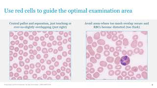 The Art and Science of Haematology Morphology [upl. by Cruce380]