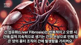 되돌릴 수 있었는데 간섬유화Liver Fibrosis [upl. by Angelika]