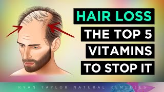 Top 5 Vitamins To PREVENT Hair Loss [upl. by Arretahs]