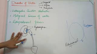 male genital system pathology lecture 9 URETER DISORDERS [upl. by Yumuk68]