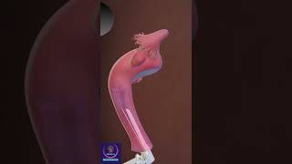 Pap Test Procedure education shorts [upl. by Adia]