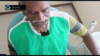 Extraoral Tracing for Complete denture [upl. by Adolph352]