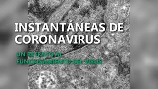 Brasil capta imágenes de momento exacto en que coronavirus infecta una célula [upl. by Baptist]