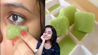 Permanent Treatment  7 Days Dark Circles Removal Challenge  Puffy Eyes Eye Bags Home Remedies [upl. by Yasmar]