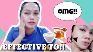 DIY YOGURT FACE MASK TO TIGHTEN PORES [upl. by Ahsatan342]