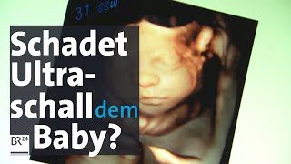 Babywatching Wie gefährlich ist 3DUltraschallUntersuchung in der Schwangerschaft für das Baby [upl. by Ocram]