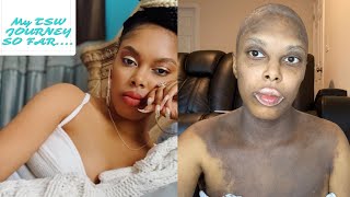 My TSW Journey so far  5 Months  ECZEMA Awareness [upl. by Odraode709]