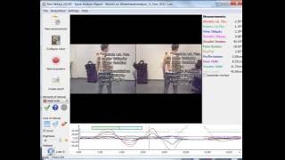 Spine Analysis protocol 3D in Simi Aktisys [upl. by Klug]