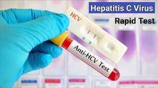 Hepatitis C Rapid Test  কিভাবে হেপাটাইটিসসি ভাইরাস পরীক্ষা করা হয়  AntiHCV RDT Test [upl. by Alian]